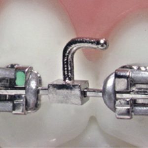 Alternative view of Arch hook Slide on Crimpable Cast 2mm